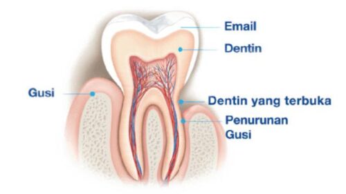 penyebab gigi sensitif